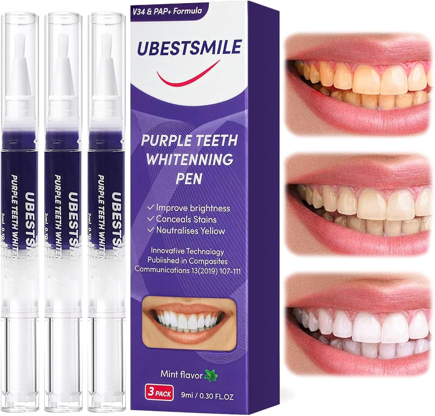 Teeth Whitening Pens - UBESTSMILE V34&PAP+ Fórmula Purple, Lápiz Blanqueador